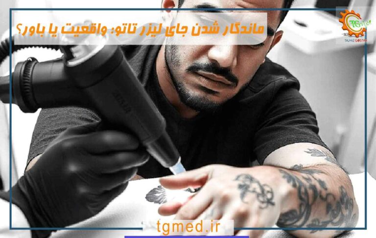 ماندگار شدن جای لیزر تاتو: واقعیت یا باور؟